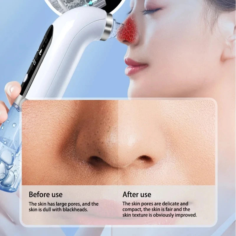 Electric Blackhead Remover Pore Vacuum Cleaner