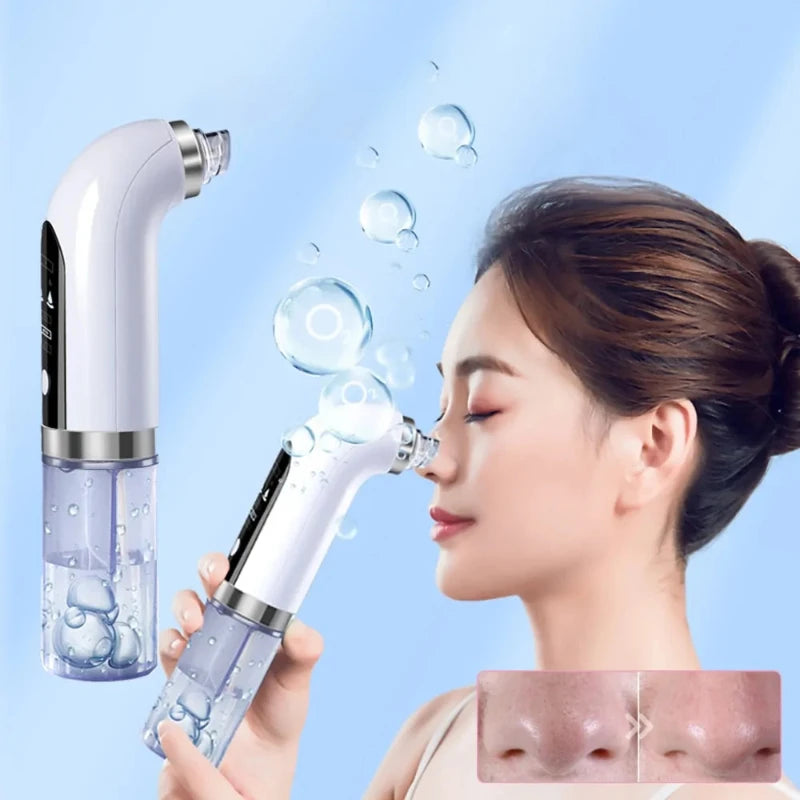 Electric Blackhead Remover Pore Vacuum Cleaner