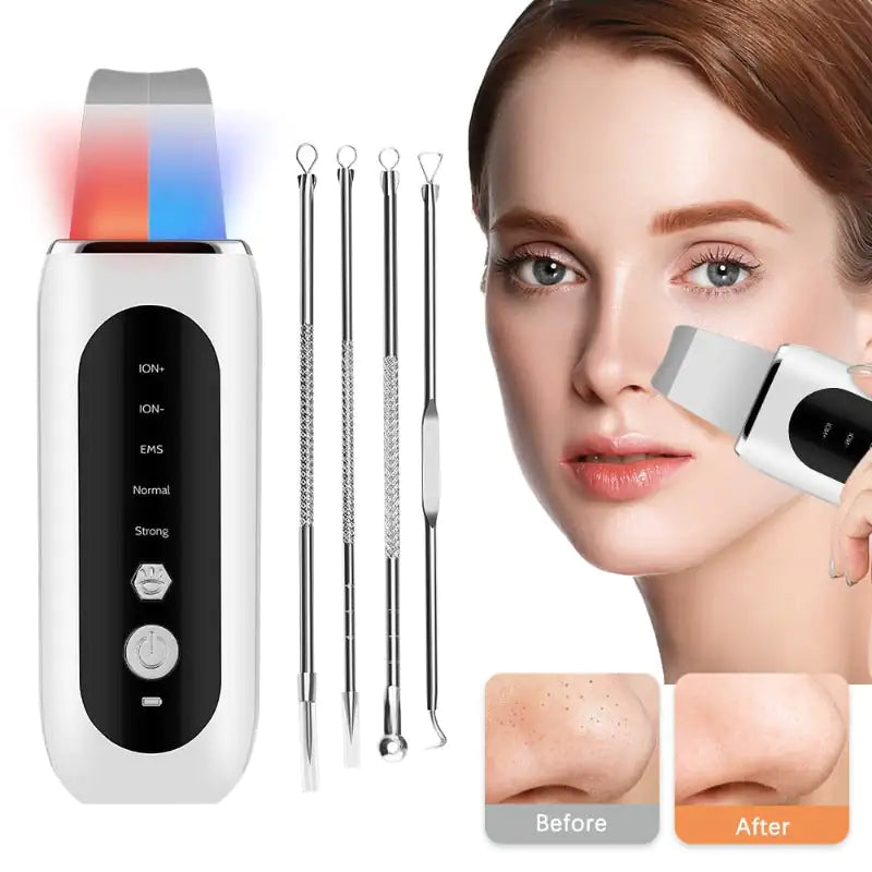 Ultrasonic Facial Skin Scrubber Device