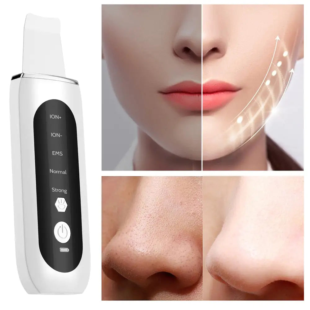 Ultrasonic Facial Skin Scrubber Device